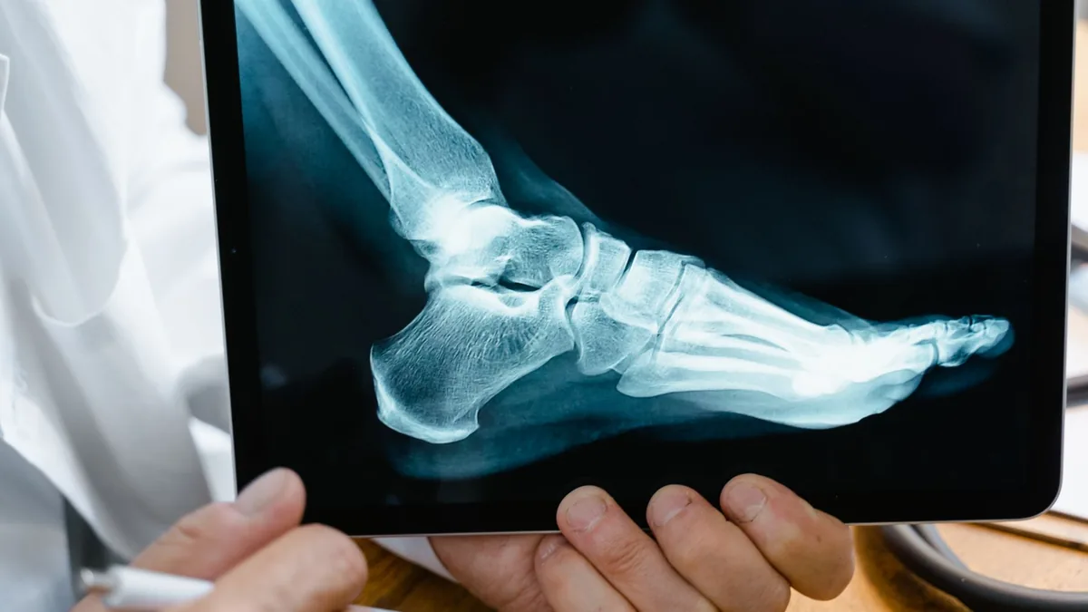Alpha-Lipoic Acid for Peripheral Neuropathy: What the Trials Show (and What They Do Not)
