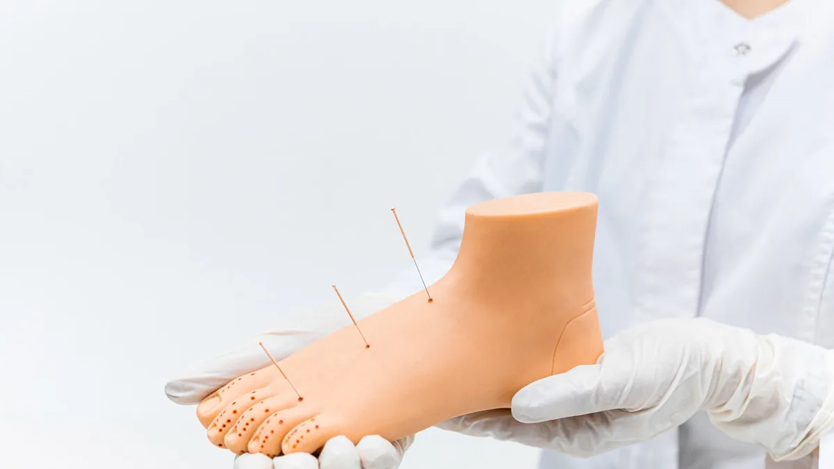 A medical practitioner demonstrates acupuncture on a foot model.