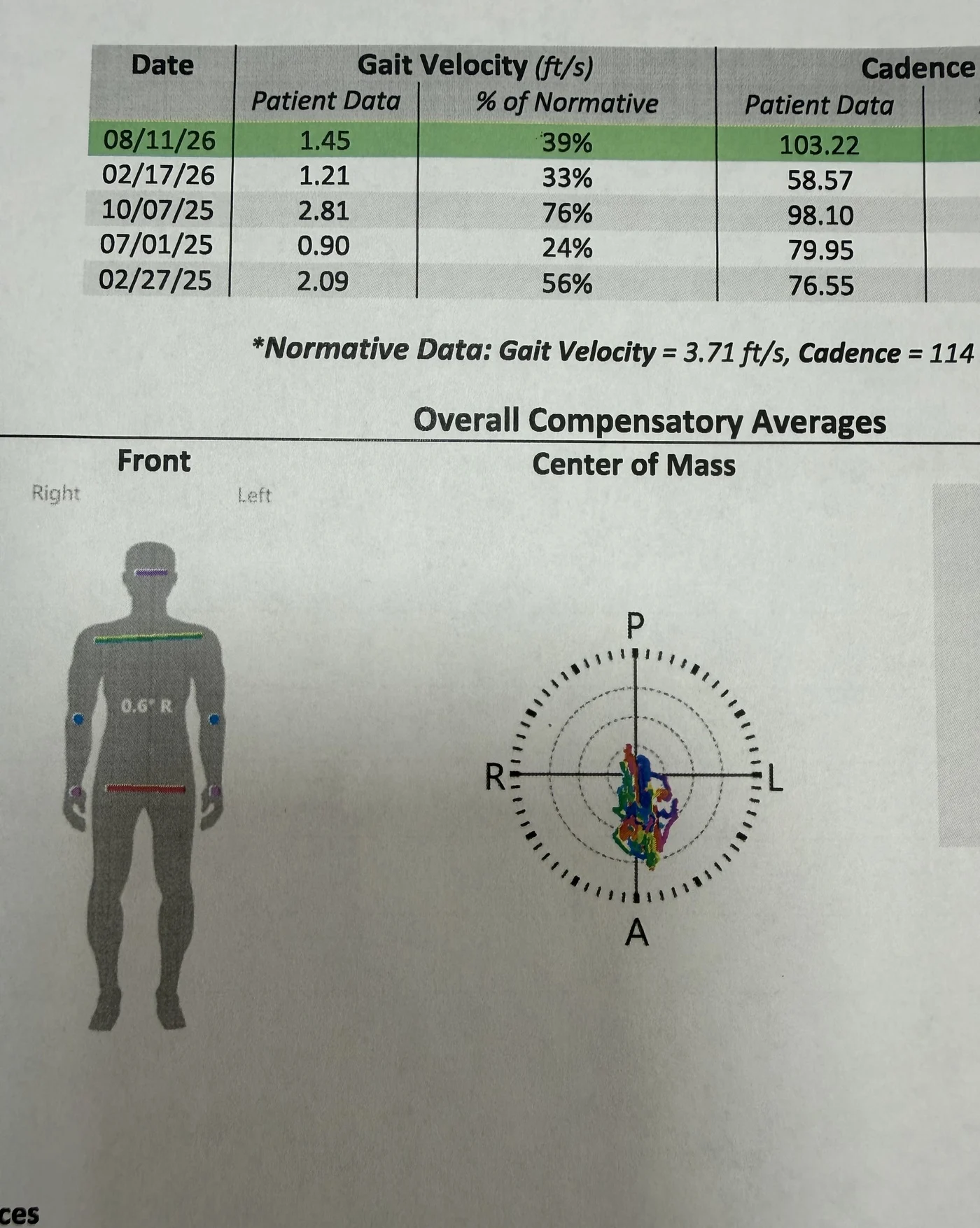 Kinetisense [Gait Analysis for Fall Analysis] report showing gait velocity and cadence against normative values across five dates, a front-view postural compensation diagram, and a center of mass sway plot recorded during active gait