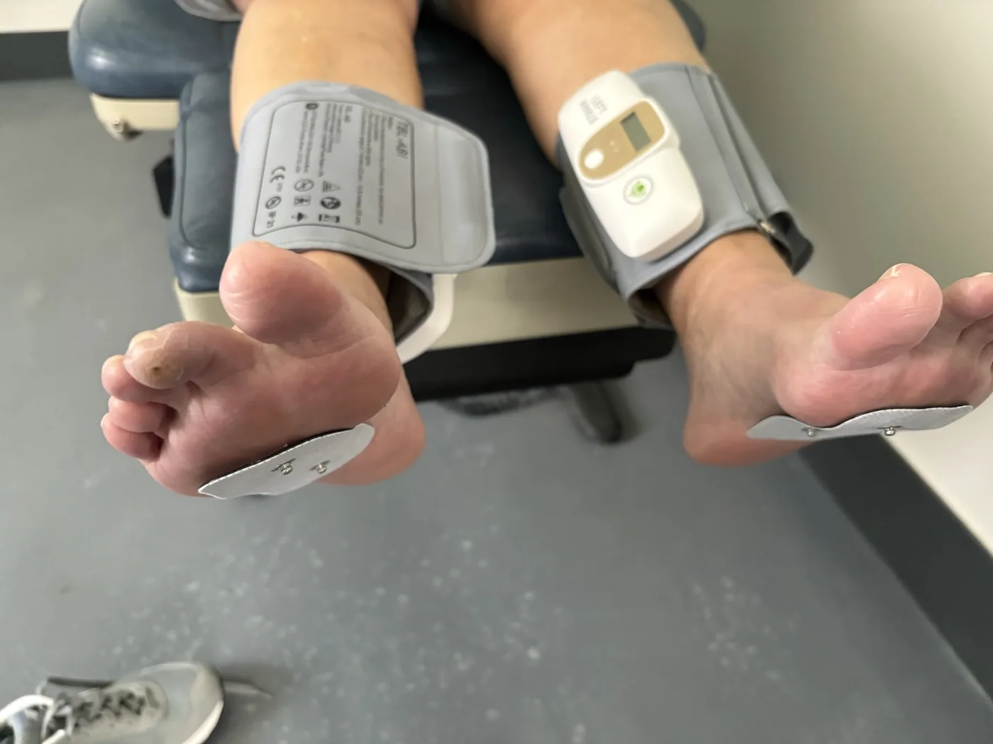 Ankle-brachial index cuffs fitted to both ankles with plantar surface electrodes on the soles for combined circulation and nerve testing of the feet at Padda Institute, St. Louis