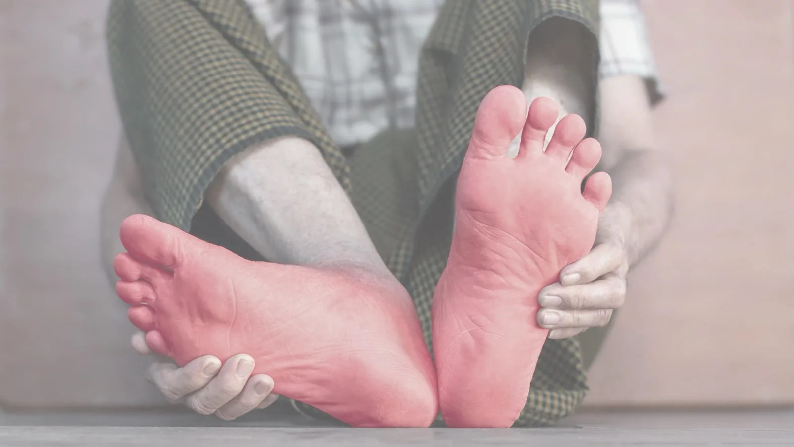Bare soles of both feet shown reddened, held by the person sitting cross-legged, illustrating the burning sensation described in peripheral neuropathy