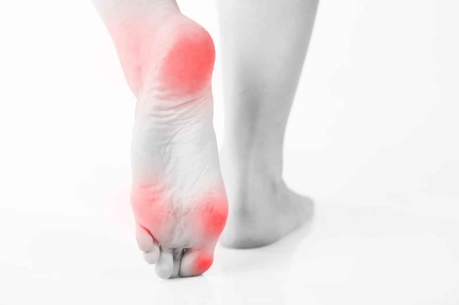 Neuropathy Foot Pain Versus Plantar Fasciitis: How to Tell the Difference
