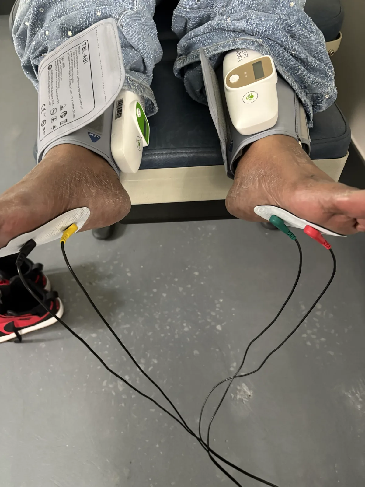 Both ankles cuffed with electrodes on the soles during small-fiber and vascular flow testing at Regenerve, 4477 Woodson Rd #104, St. Louis, MO 63134